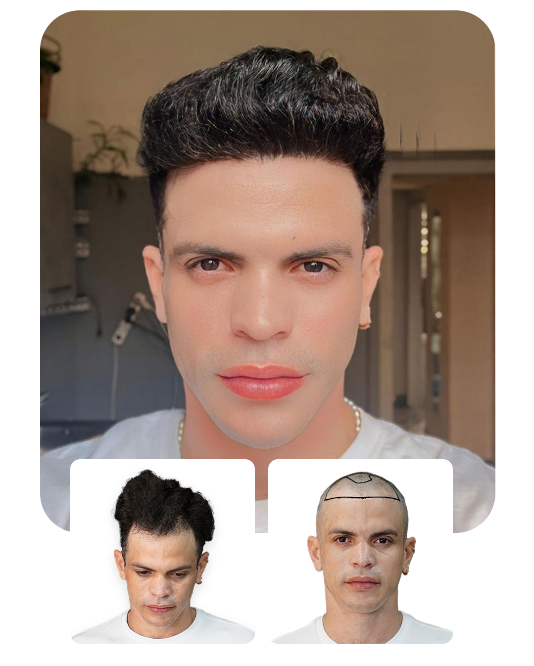 Douglus BEfore and After