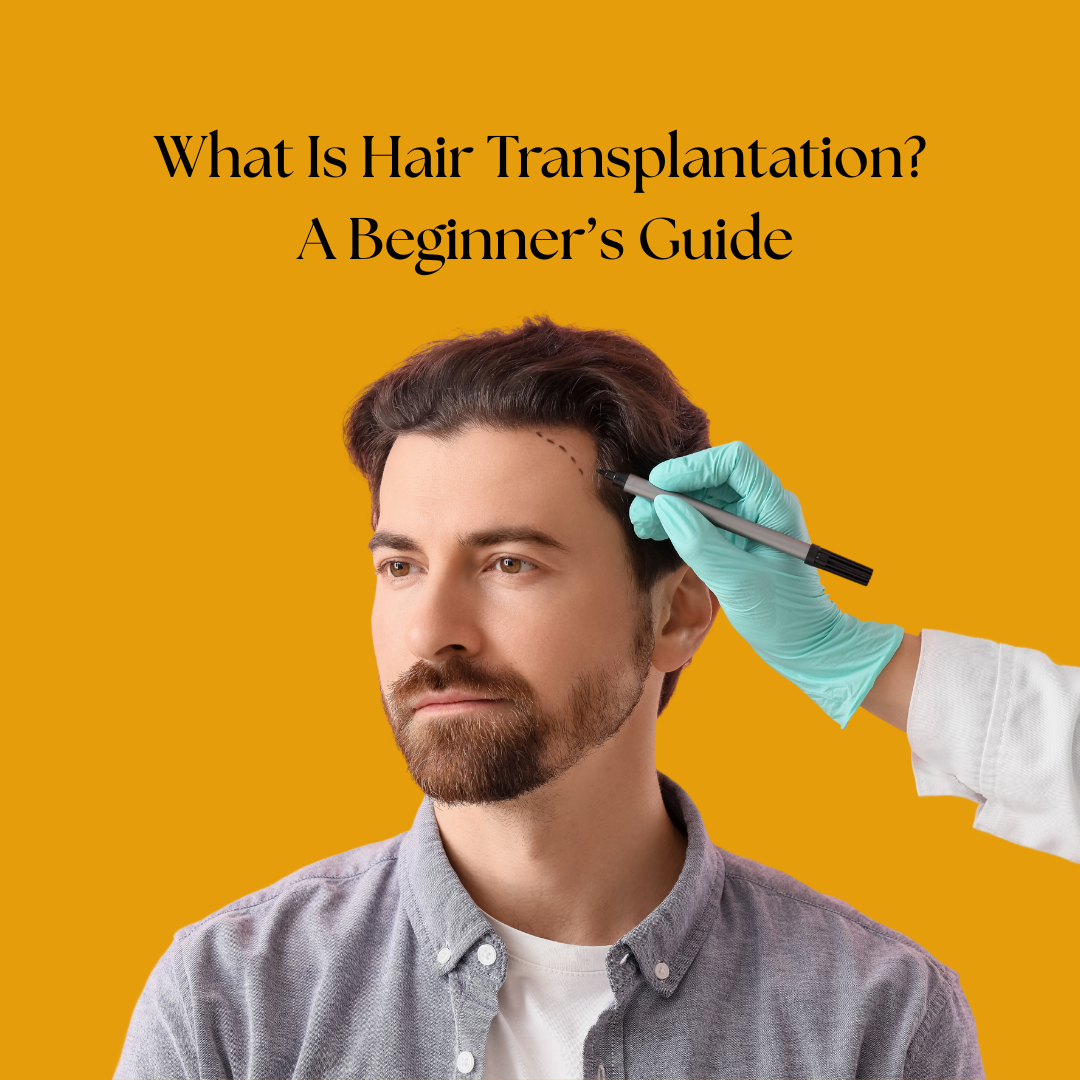 What Is Hair Transplantation? A Beginner’s Guide