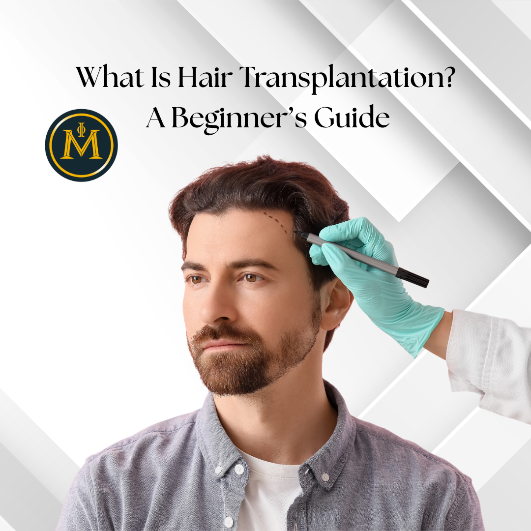 What Is Hair Transplantation? A Beginner’s Guide