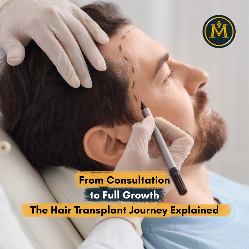 From Consultation to Full Growth The Hair Transplant Journey Explained