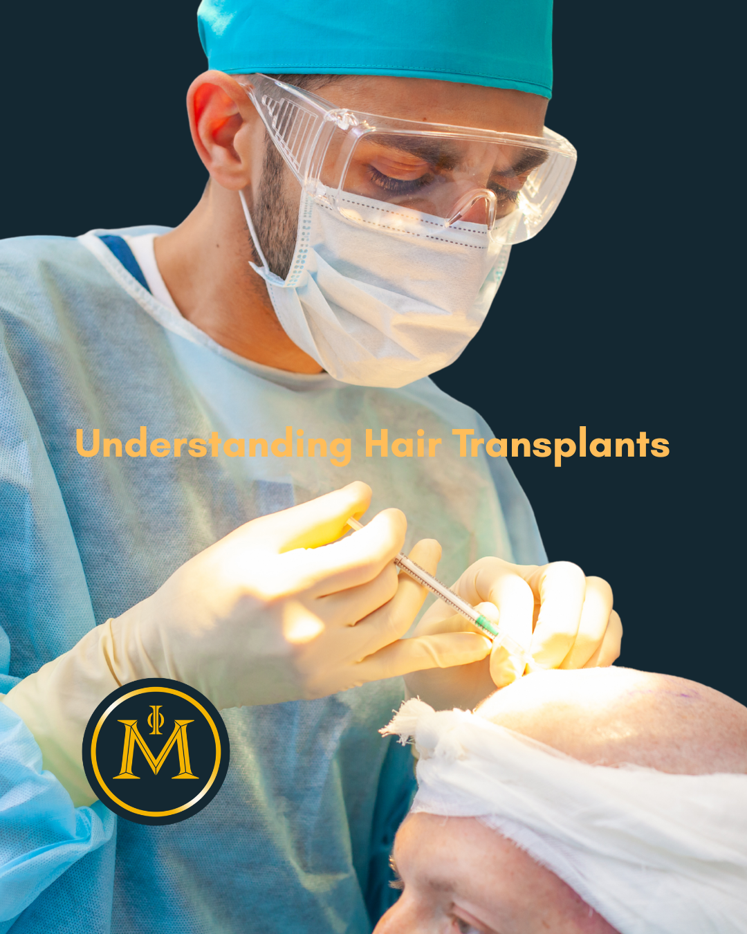 Understanding Hair Transplants